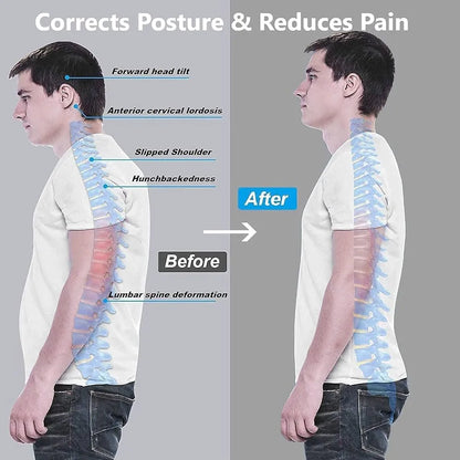 Back Smart Posture Corrector